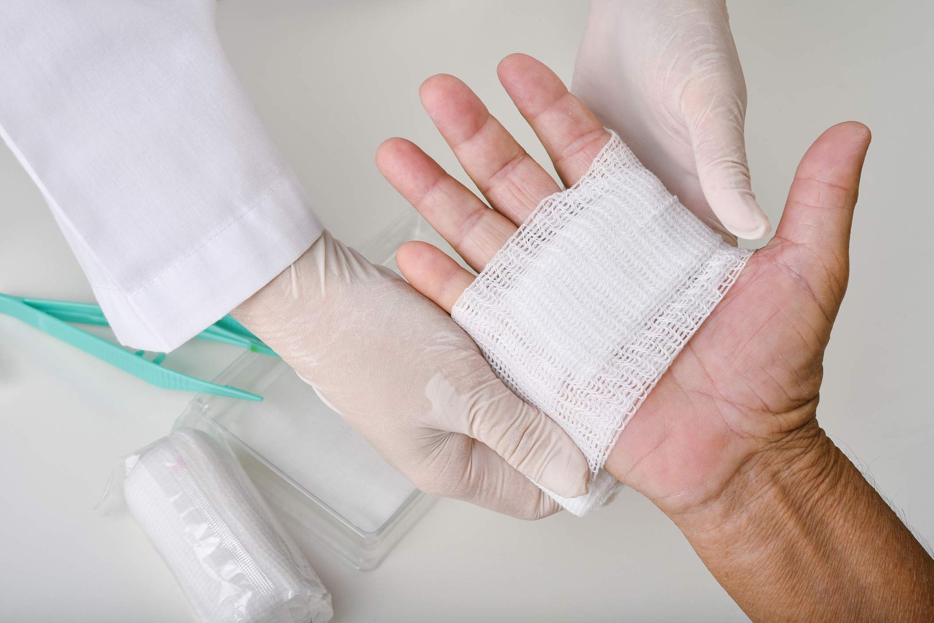 Gloved hands applying gauze to a patient’s palm in a wound care clinic setting.