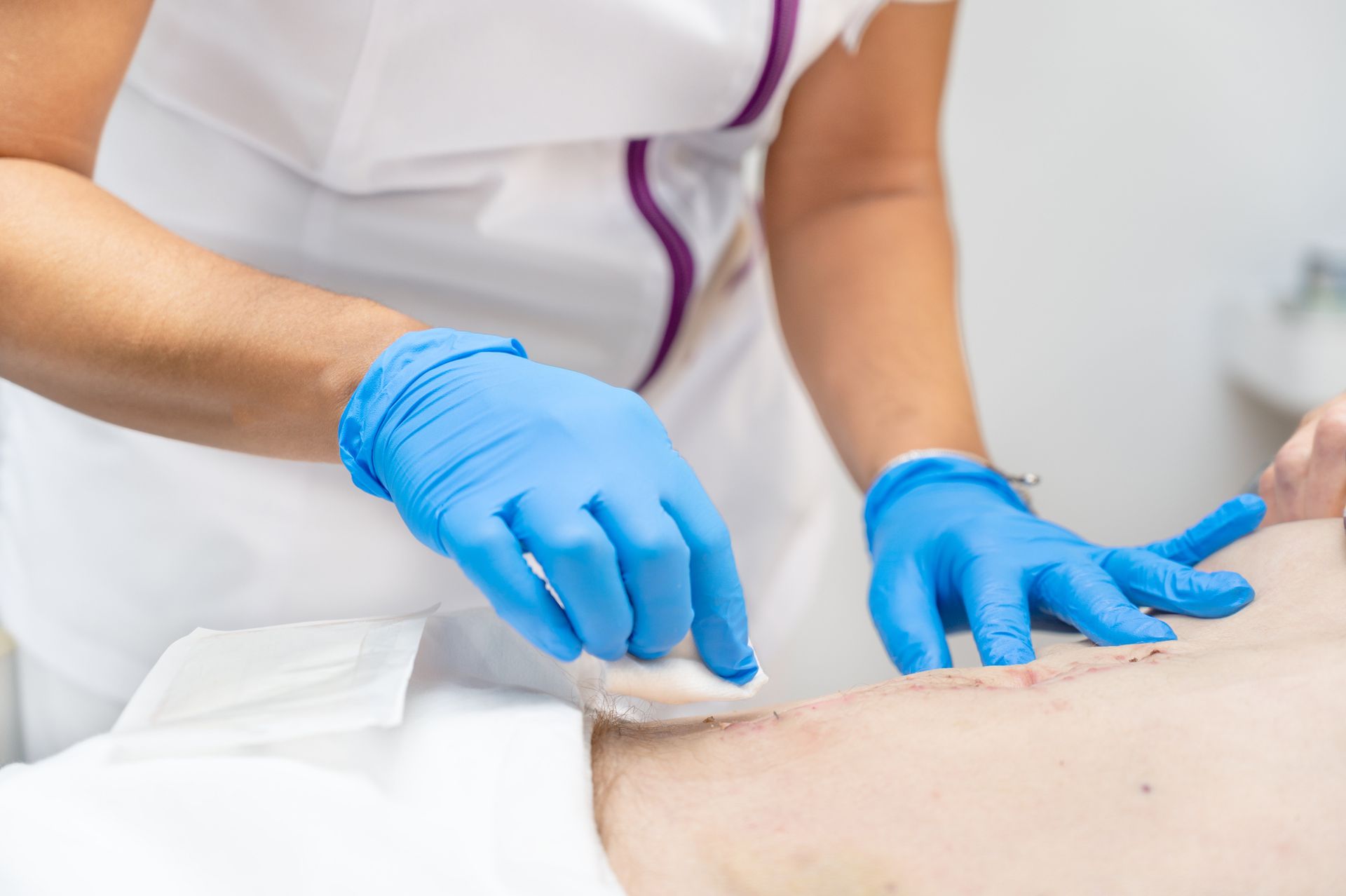 Image of a wound care doctor in Jacksboro, TN, treating a wound on a patient's lower abdomen.