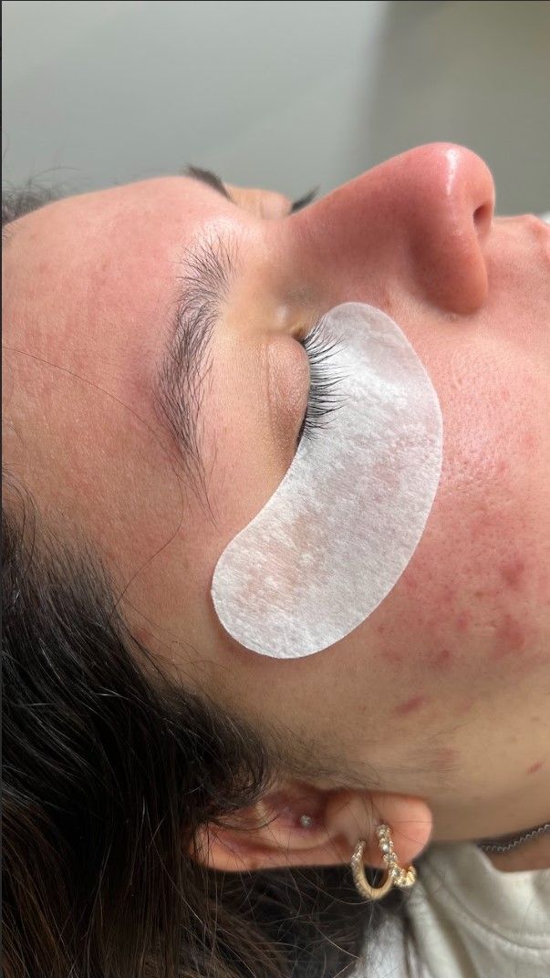 A close up of a woman 's face with a patch on her eye.