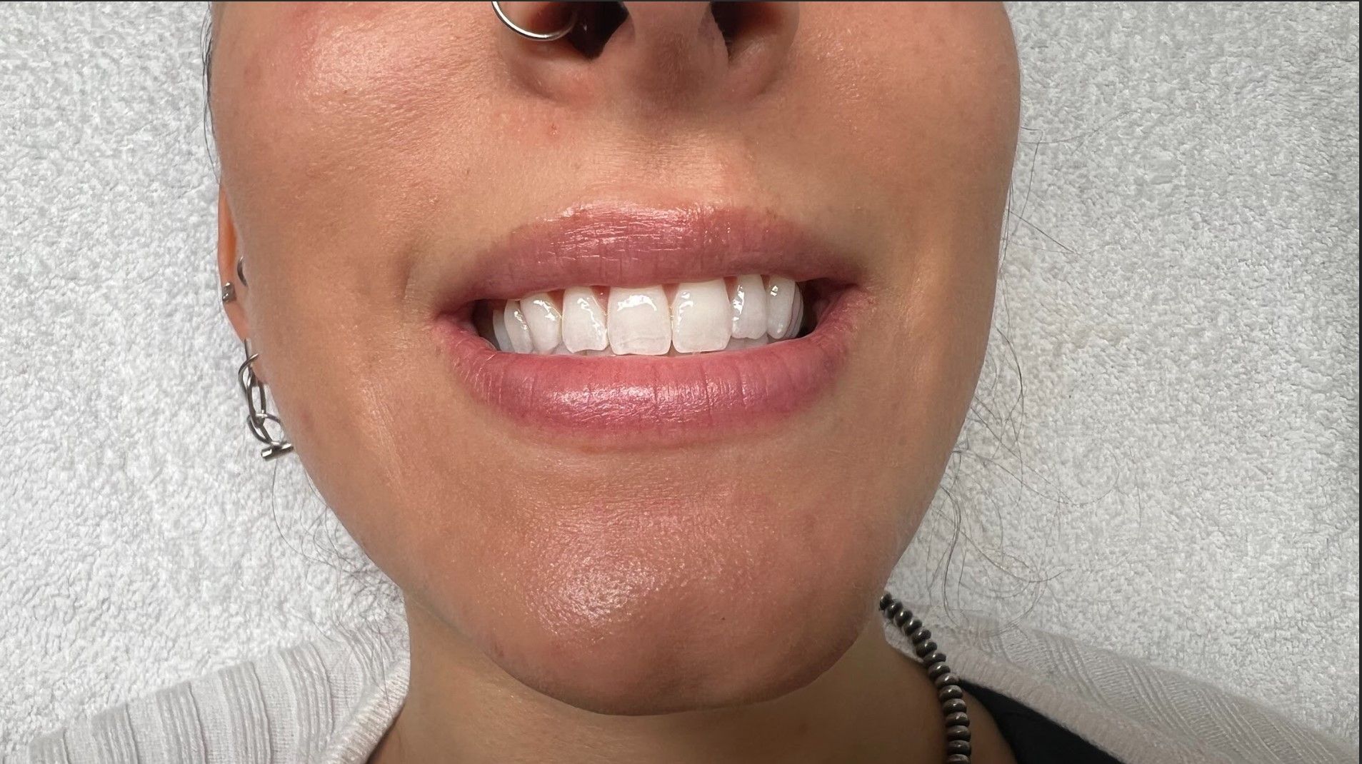 A close up of a woman 's mouth with her teeth showing.