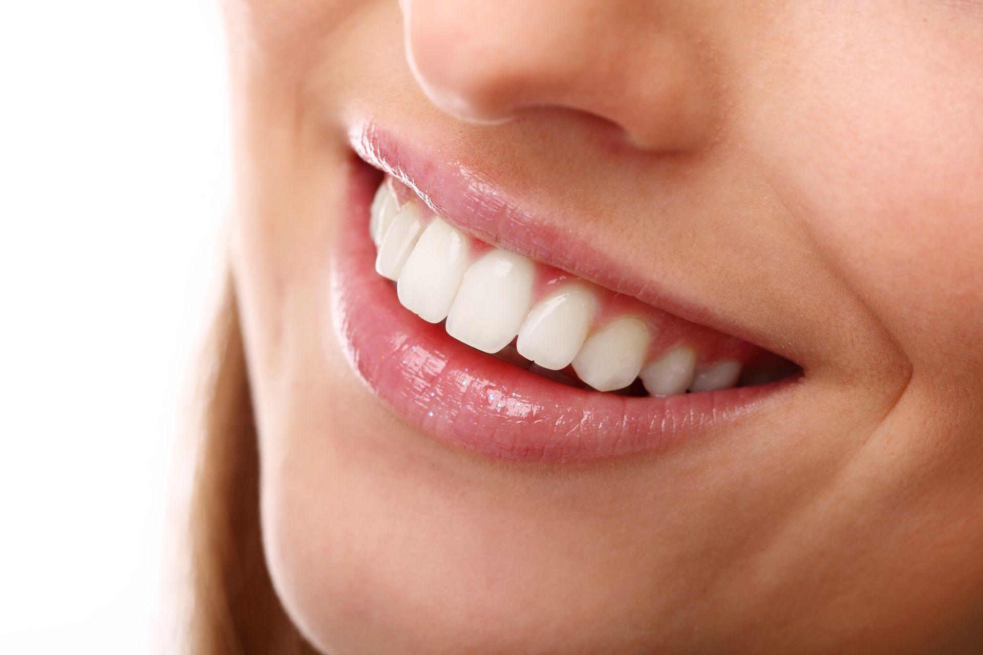 A close up of a woman 's smile with white teeth.