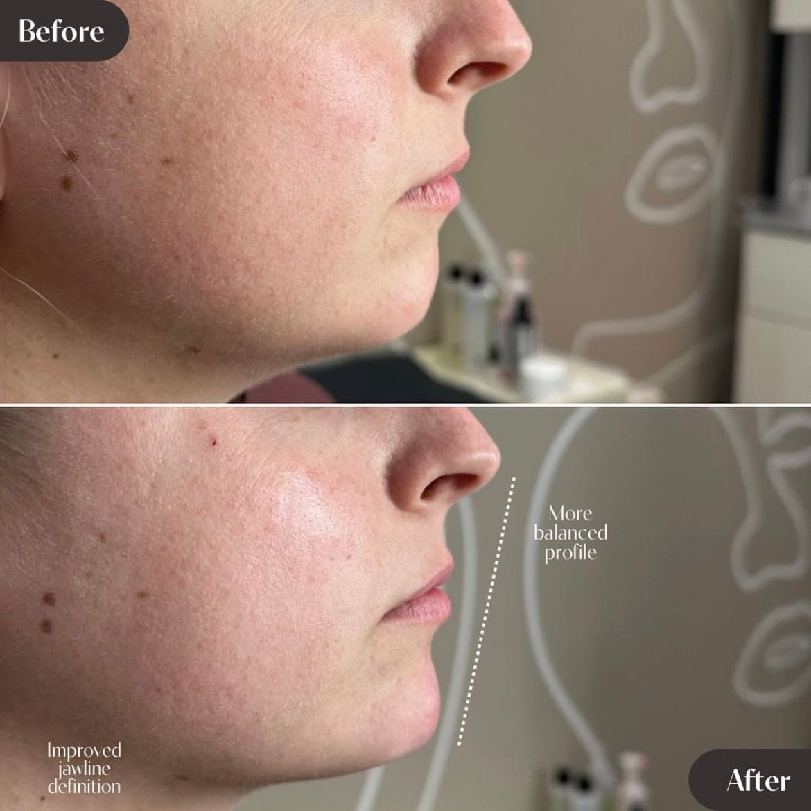 A before and after photo of a woman 's face