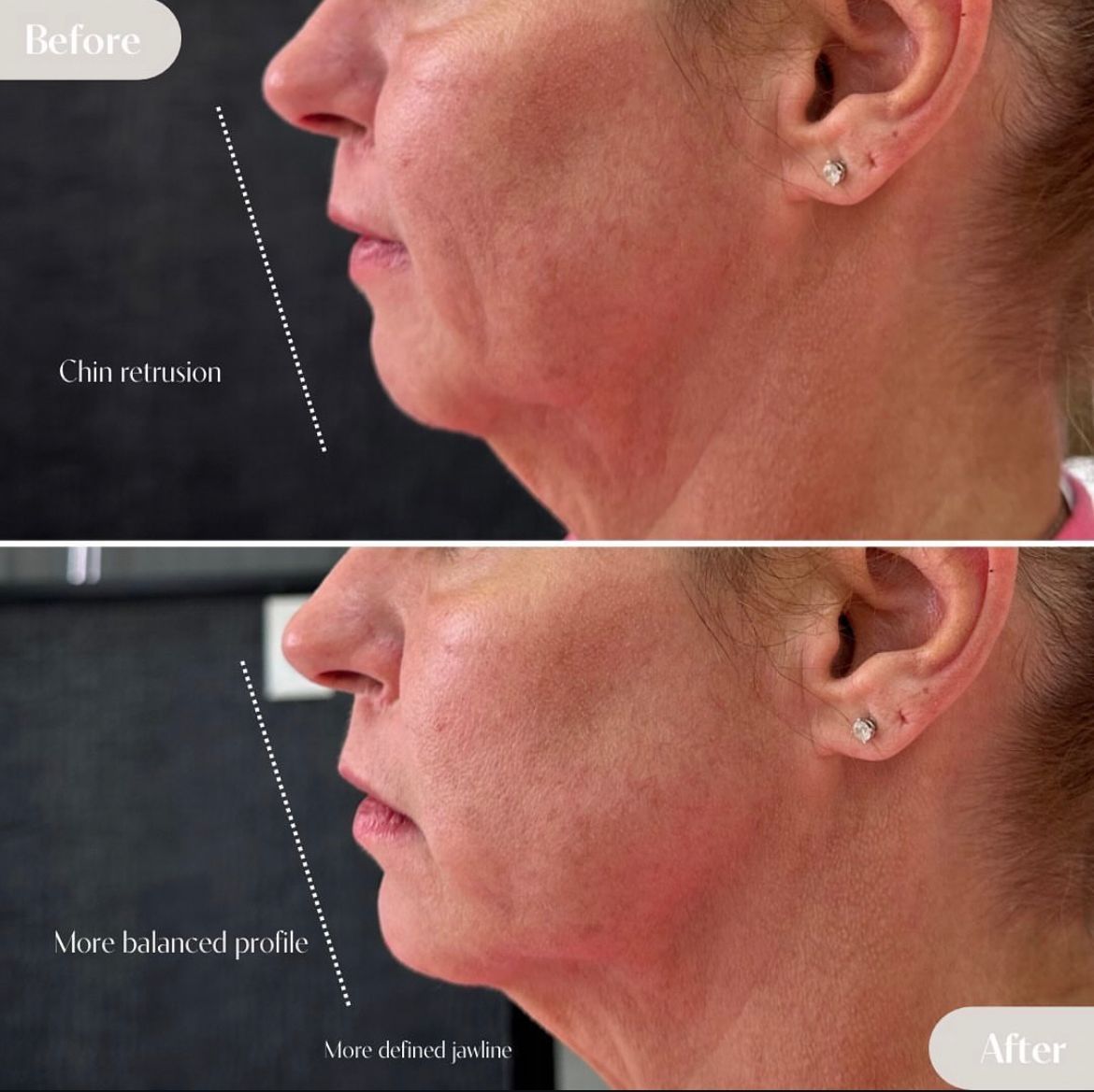 A before and after photo of a woman 's face