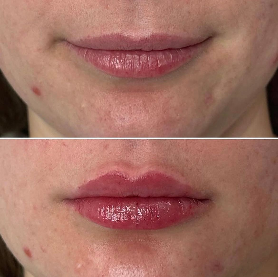 A before and after photo of a woman 's lips.