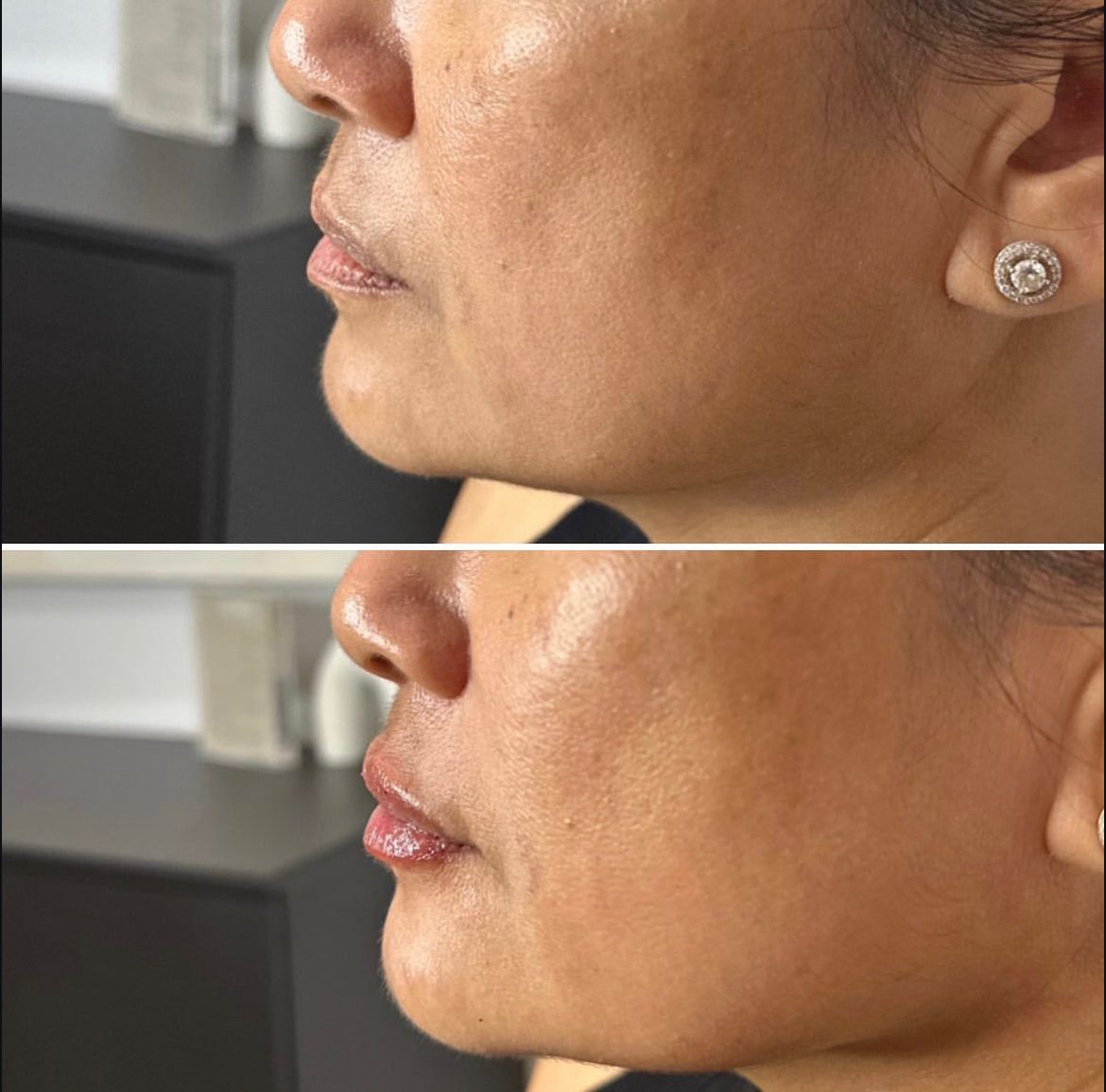 A before and after photo of a woman 's face with earrings.