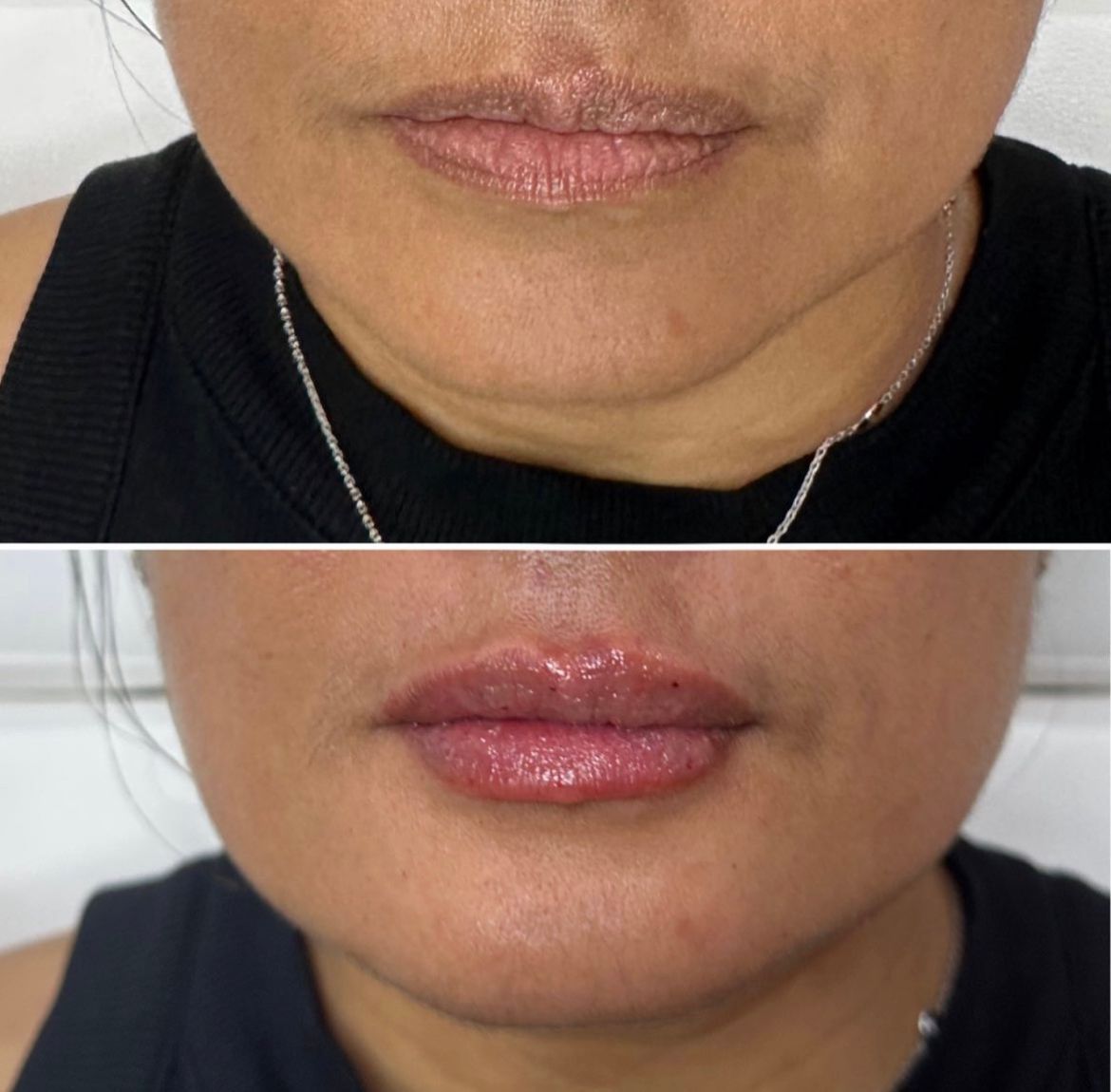 A before and after photo of a woman 's face