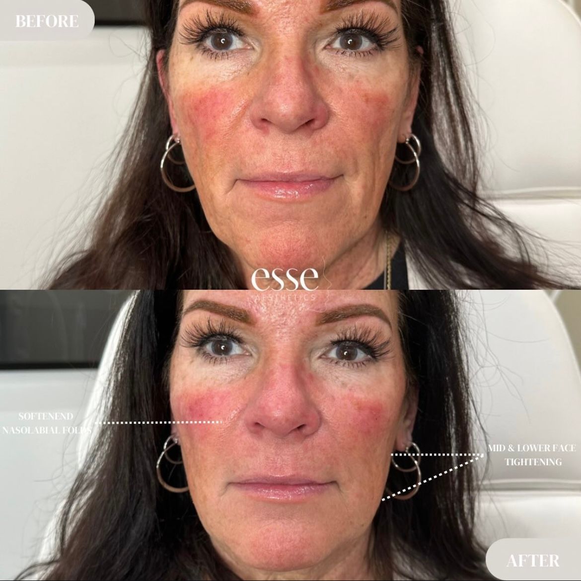 A before and after photo of a woman 's face.