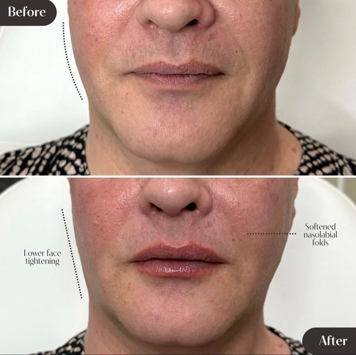 A before and after photo of a woman 's face