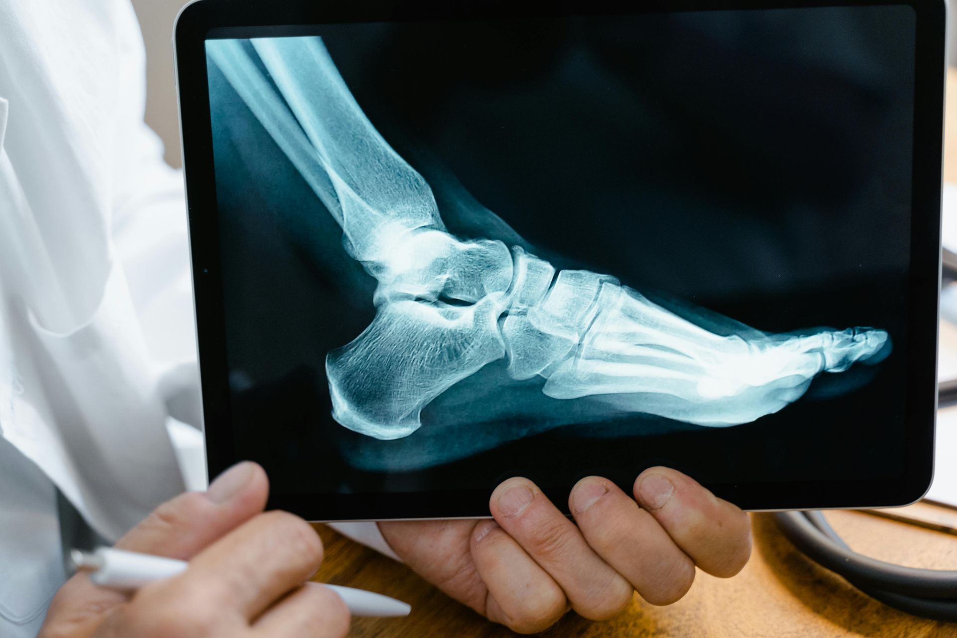 A doctor is holding a tablet with an x-ray of a foot on it.