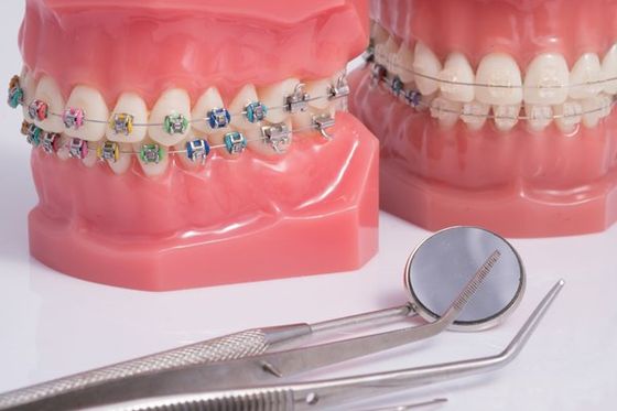 dente con impianto