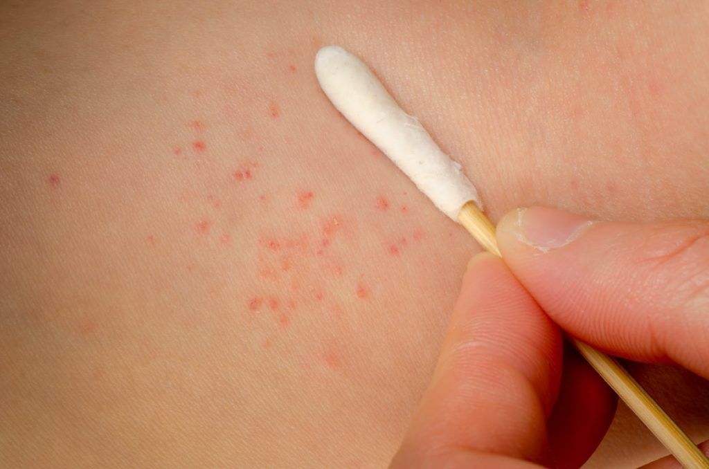 Consultorio Dermatológico Dra Catalina Gareis - Tratamientos estéticos en La Plata