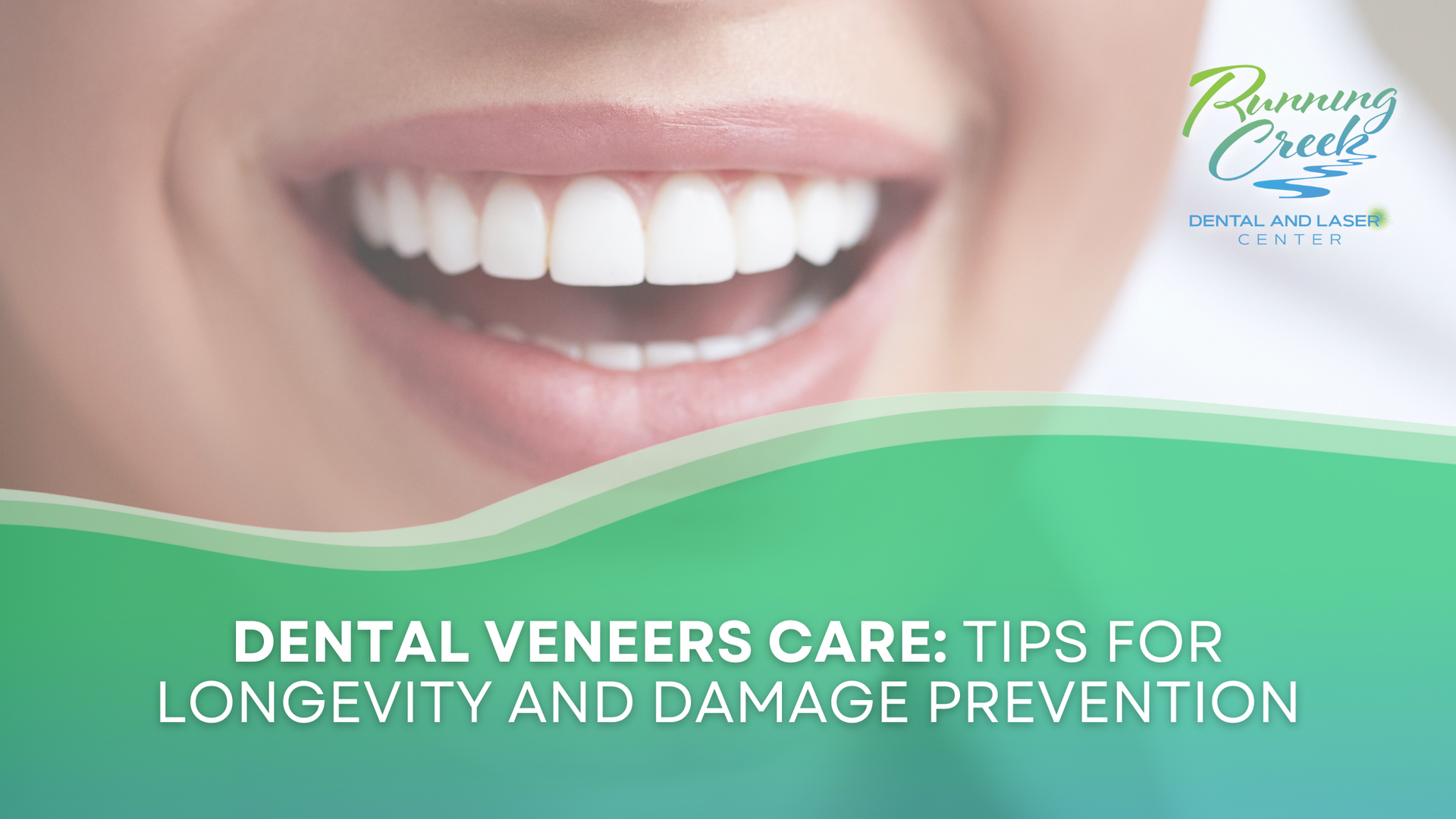 Dental veneers care : tips for longevity and damage prevention