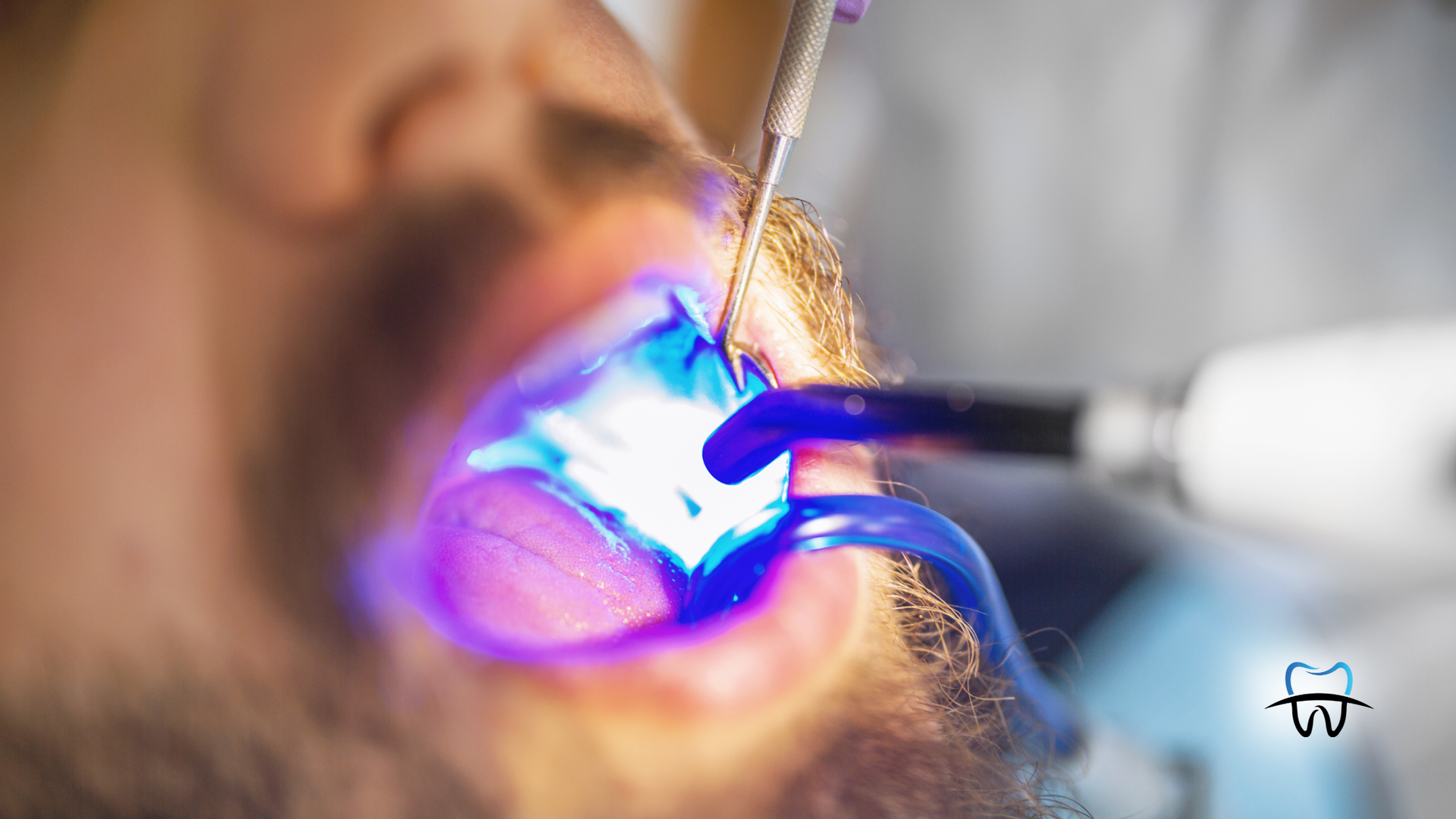 Dentist using blue light on patient's mouth for dental work.