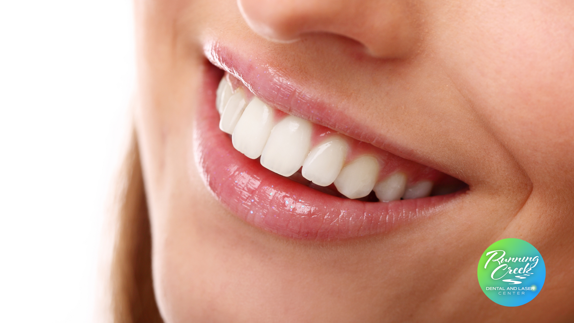 A close up of a woman 's smile with white teeth.