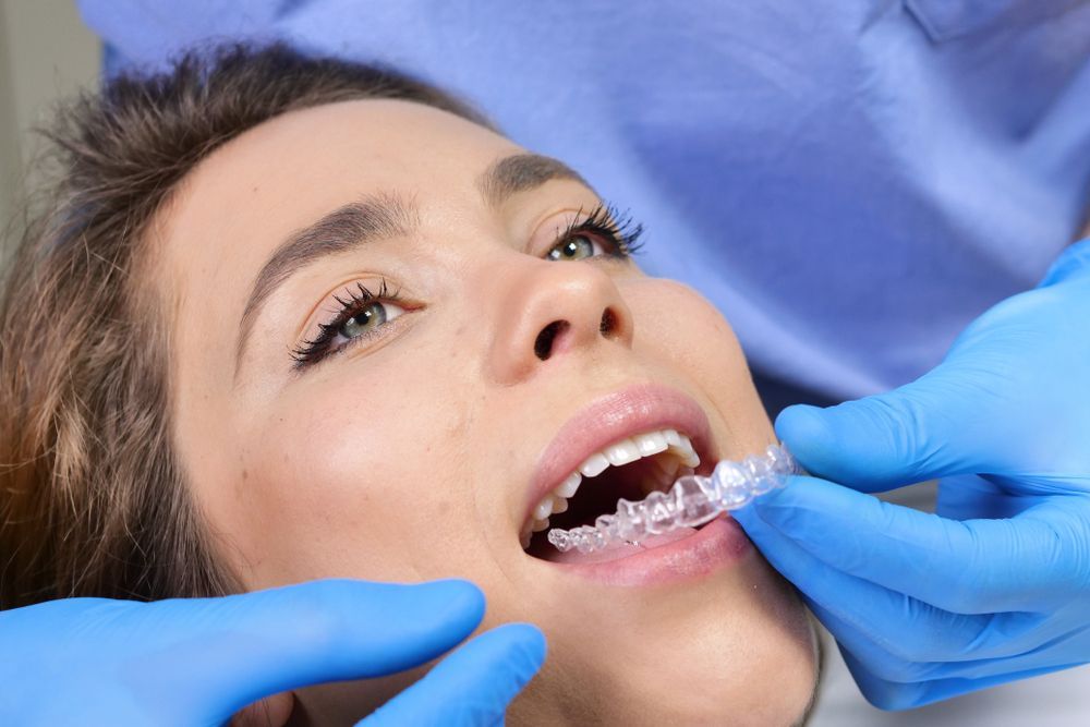 Dentist placing clear aligner in patient's mouth. Gloves, blue shirt, light skin.