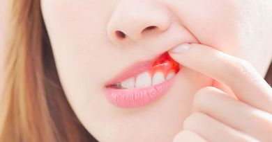 Woman with inflamed gums, a finger pointing to red, bleeding area.
