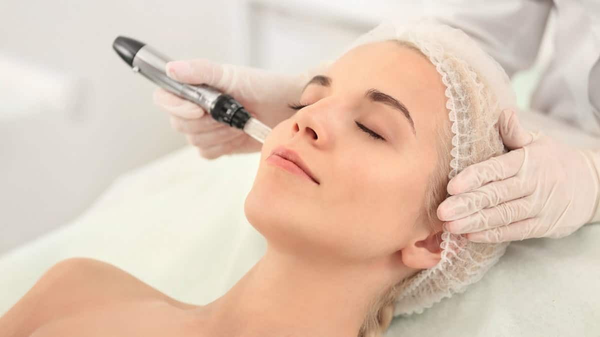 Derma Pen Micro-Needling in Cardiff