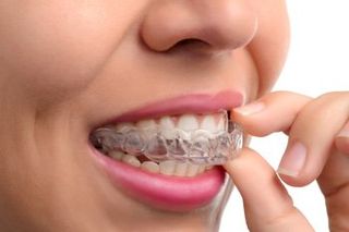Woman Wearing Orthodontic Silicone Trainer - Professional Dentistry in Rancho Cuchamonga, CA