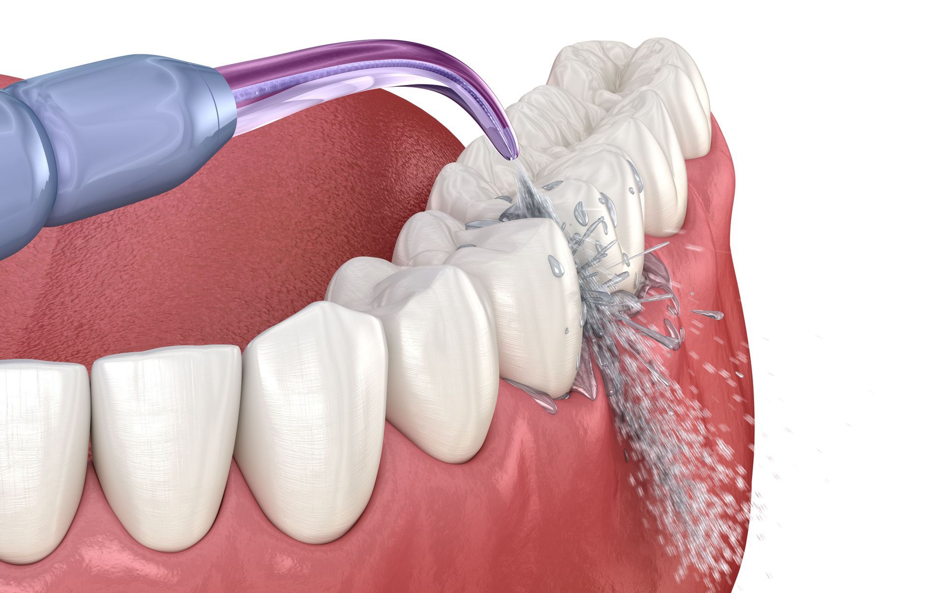 A close up of a person cleaning their teeth with a water irrigator
