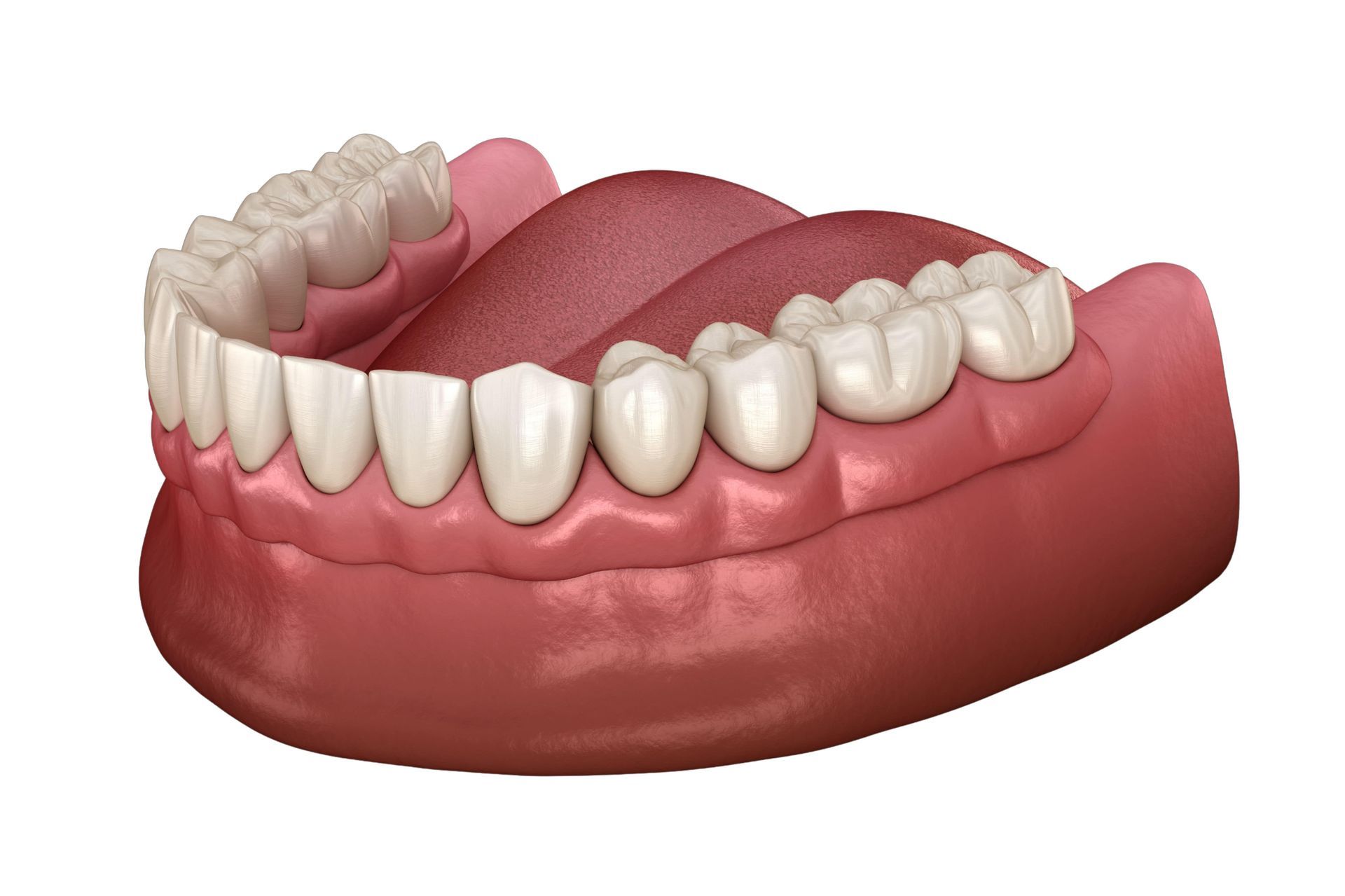 A model of a person 's teeth and gums on a white background.