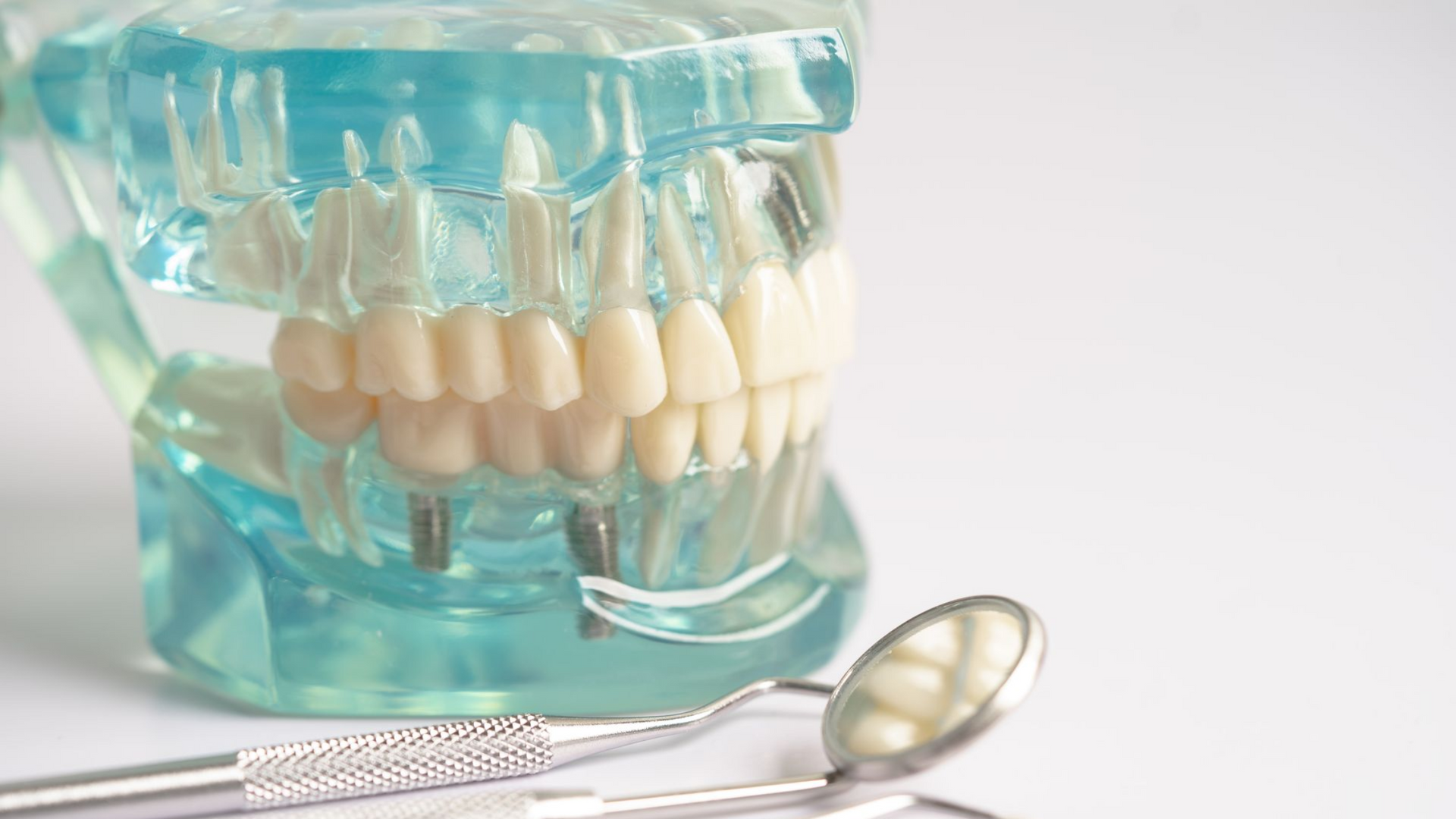 Dental model with teeth, dental mirror, and dental probe.