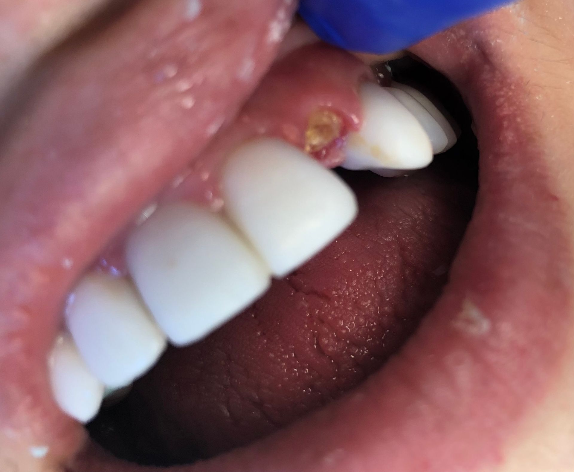 A close up of a person 's mouth with white teeth