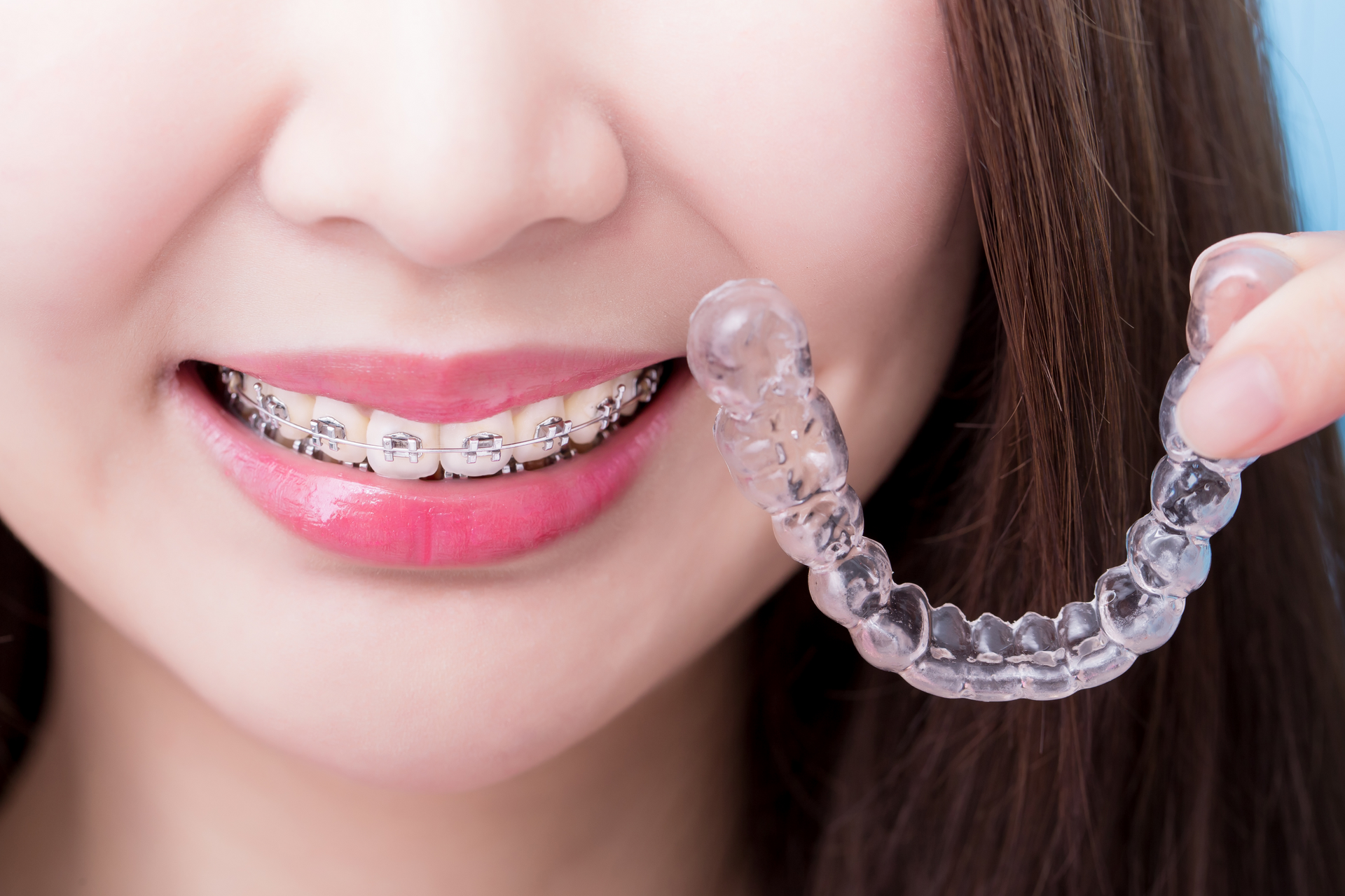 A woman with braces is holding a clear braces retainer in her mouth.