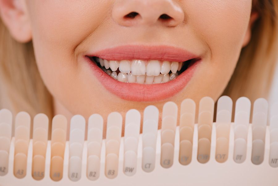 A close up of a woman 's teeth with a tooth color chart in front of her.