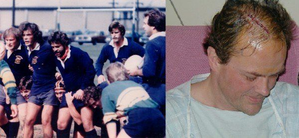 A group of men playing rugby next to a man in a hospital gown