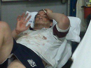 A man in a white shirt and blue shorts is laying in a hospital bed