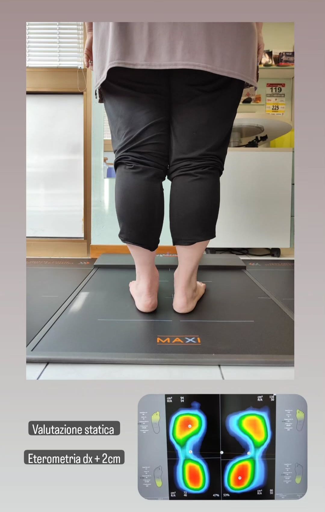 esame baropodometrico