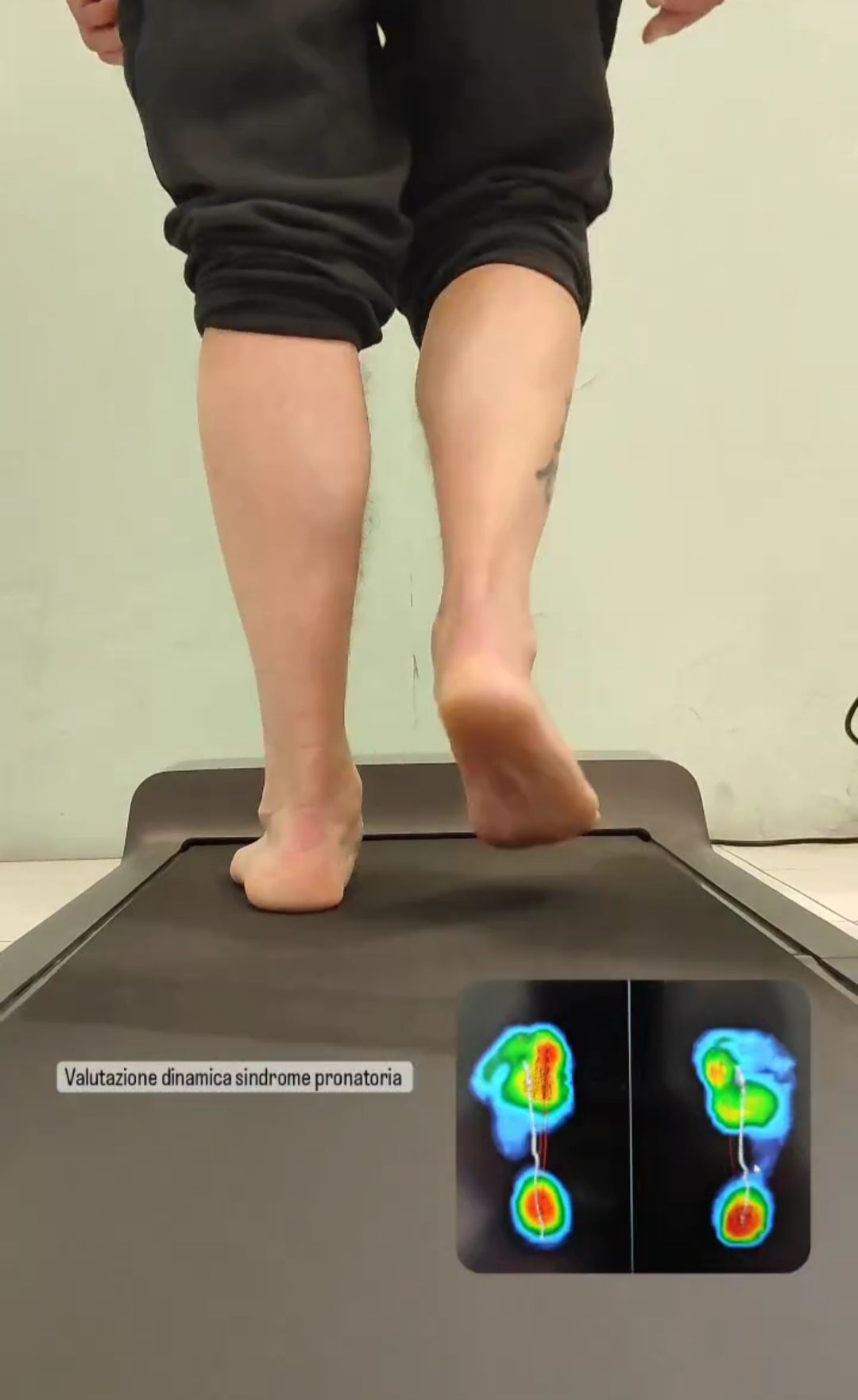 esame baropodometrico