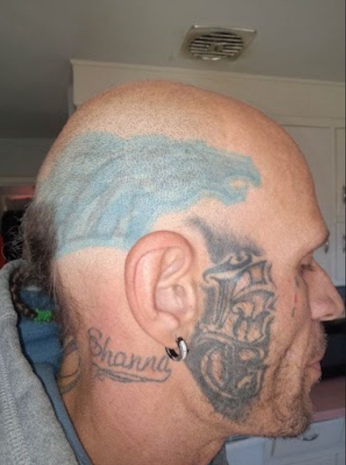 Cover-up Head Tattoo Before