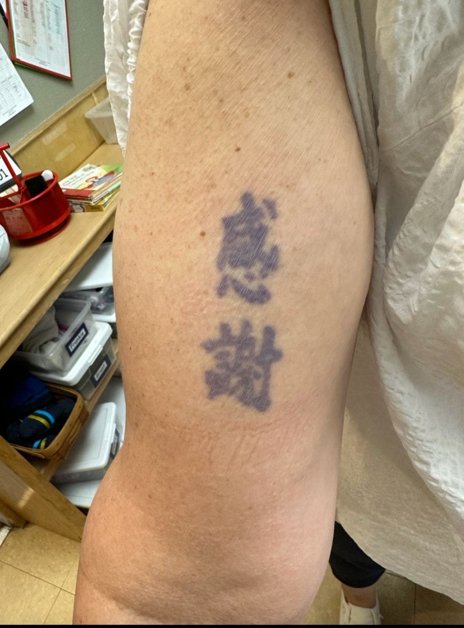 Cover-up Flower Tattoo Before