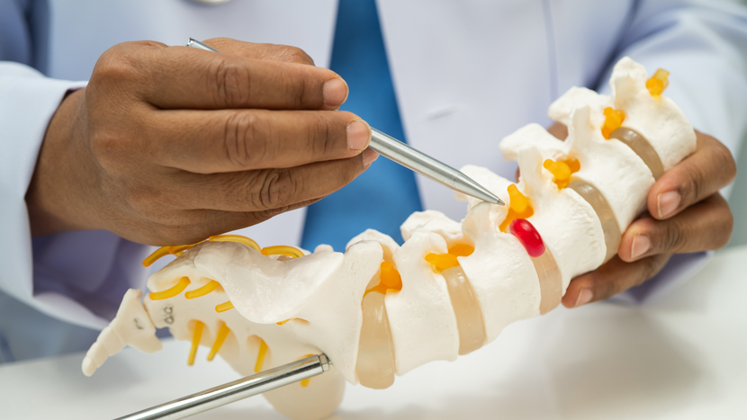 A medical professional uses a metal tool to point at a specific vertebra on a model of a human spine.