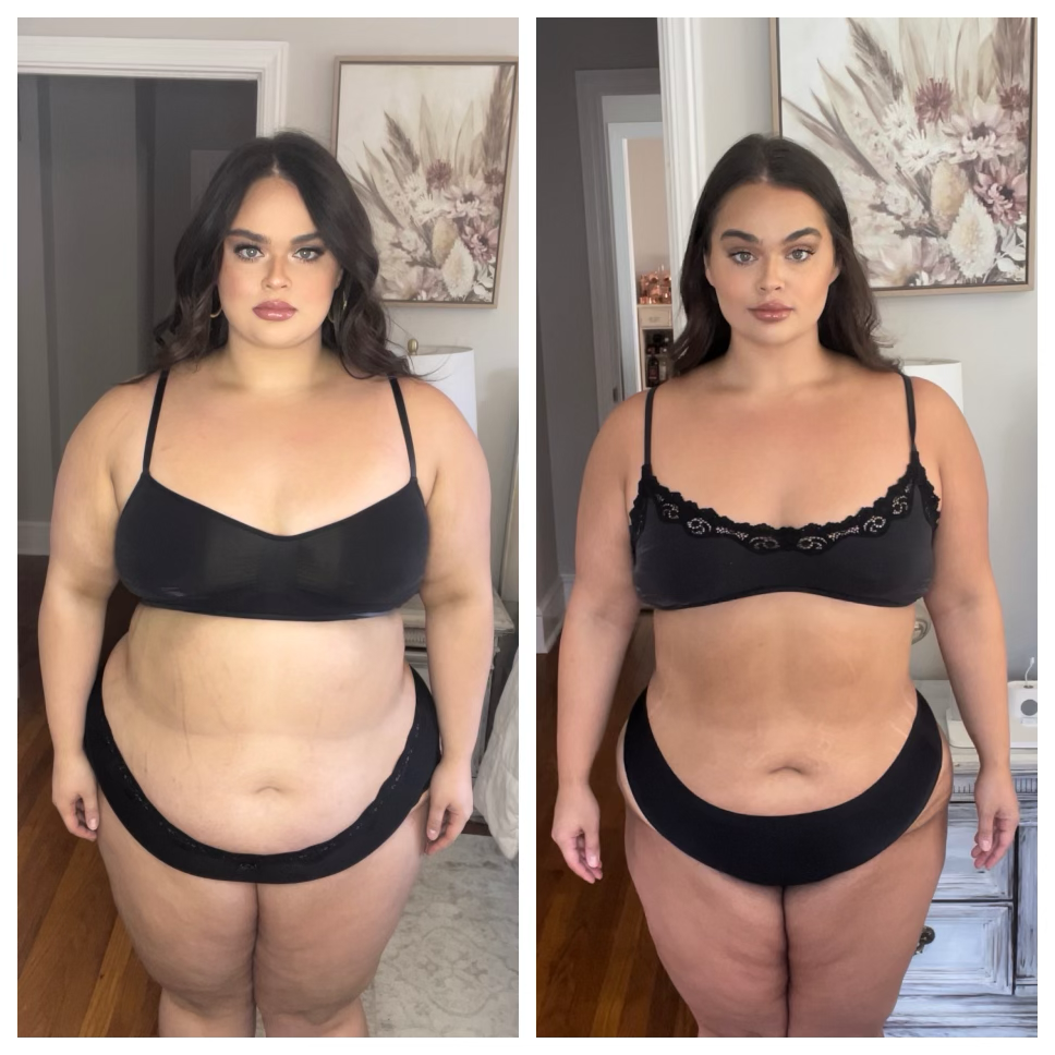 85 lbs down over 11 months on semaglutide injections