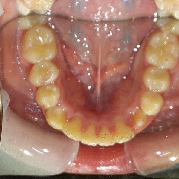 A close up of a person 's mouth showing their teeth