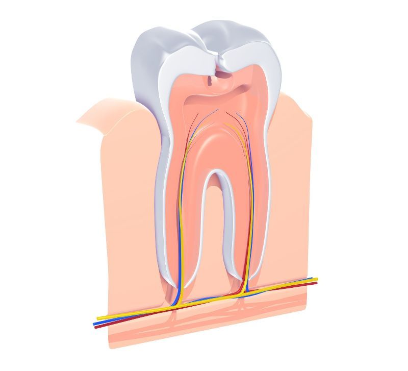 Root Canals