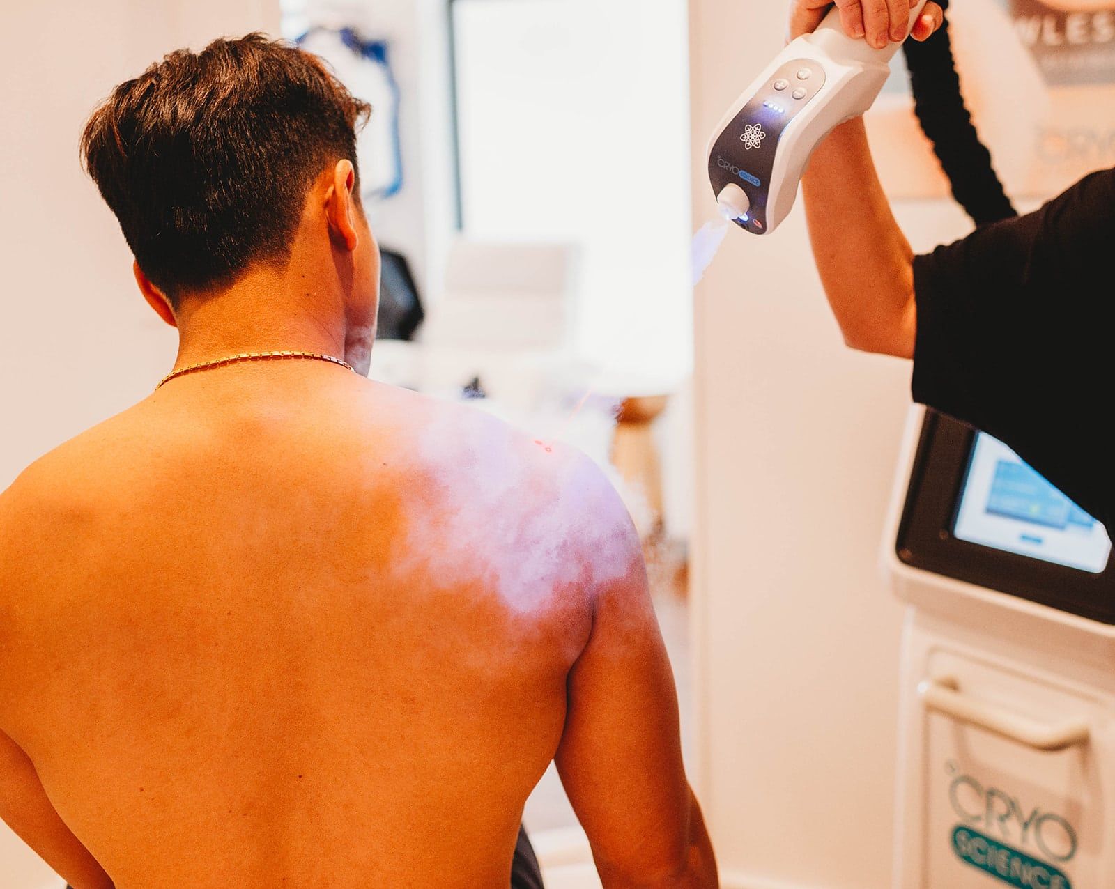 Back view of a man getting a cryotherapy spot treatment on his shoulder