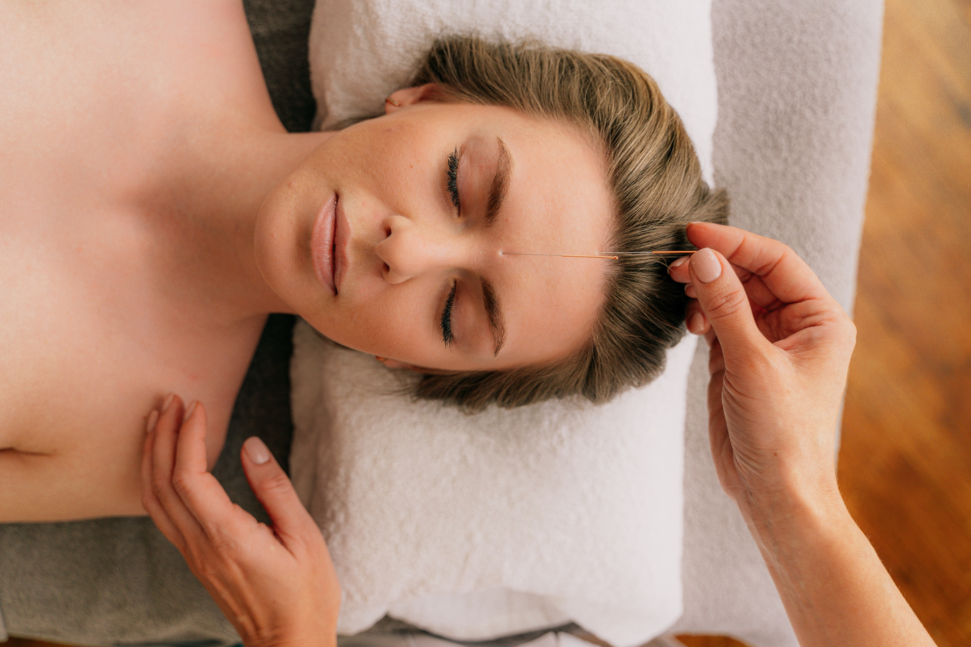 A woman is laying on a bed getting an acupuncture treatment.