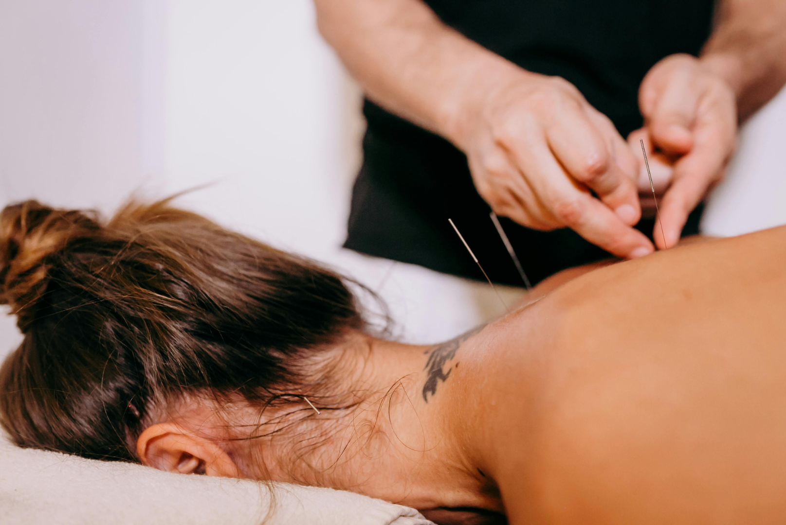 A woman recieving trigger point acupuncture at TLC Massage