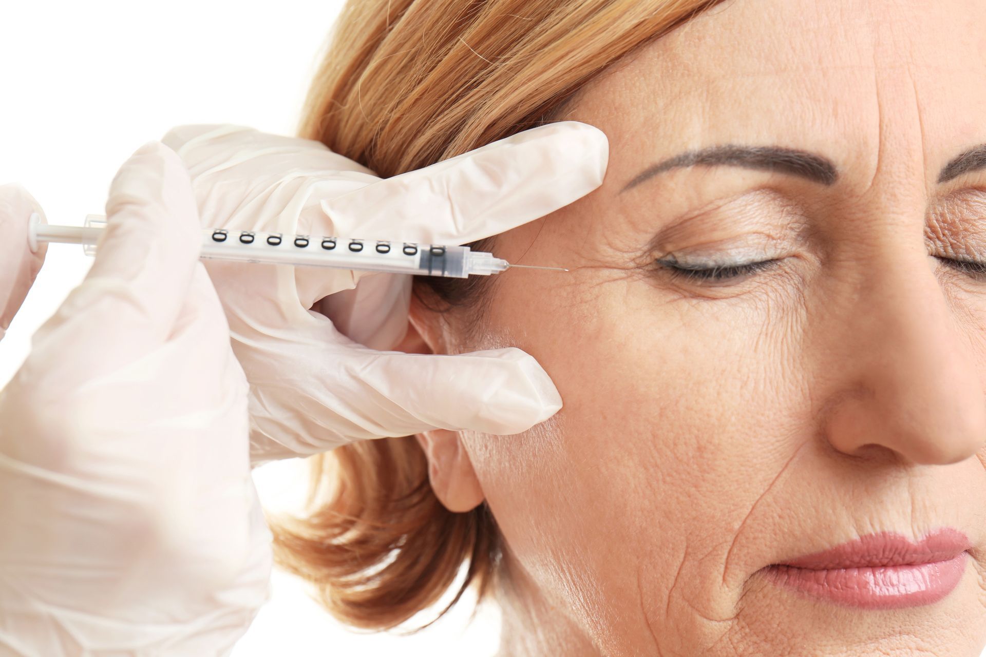 Eine Frau bekommt eine Botox-Injektion in die Stirn.