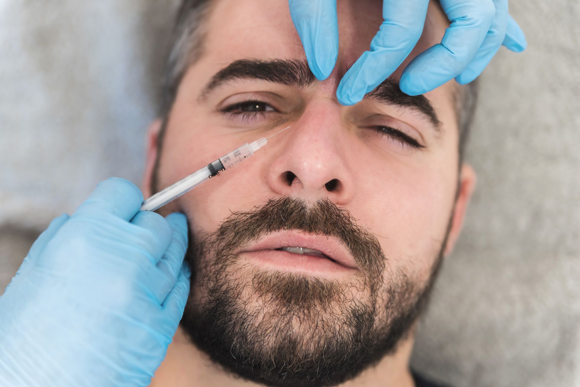 Ein Mann mit Bart bekommt eine Botox-Injektion in die Stirn.
