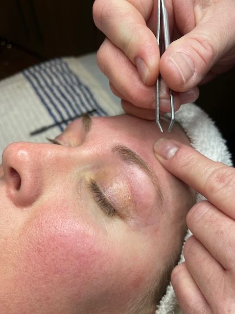 A person is using tweezers to remove hair from a woman 's face