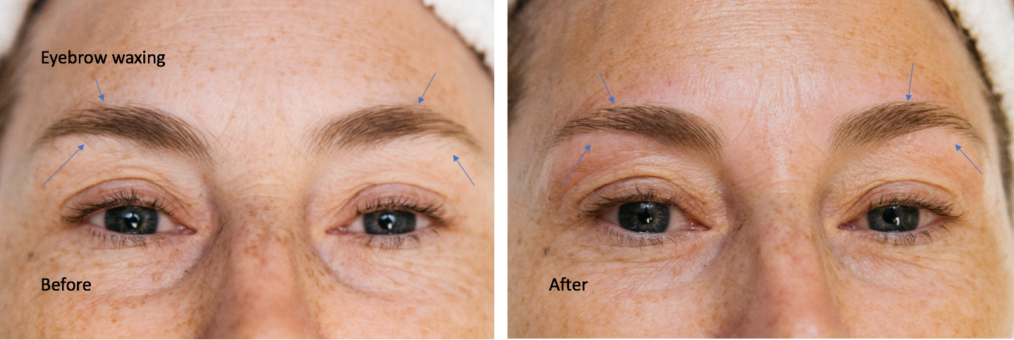 A before and after picture of a woman 's eyebrows