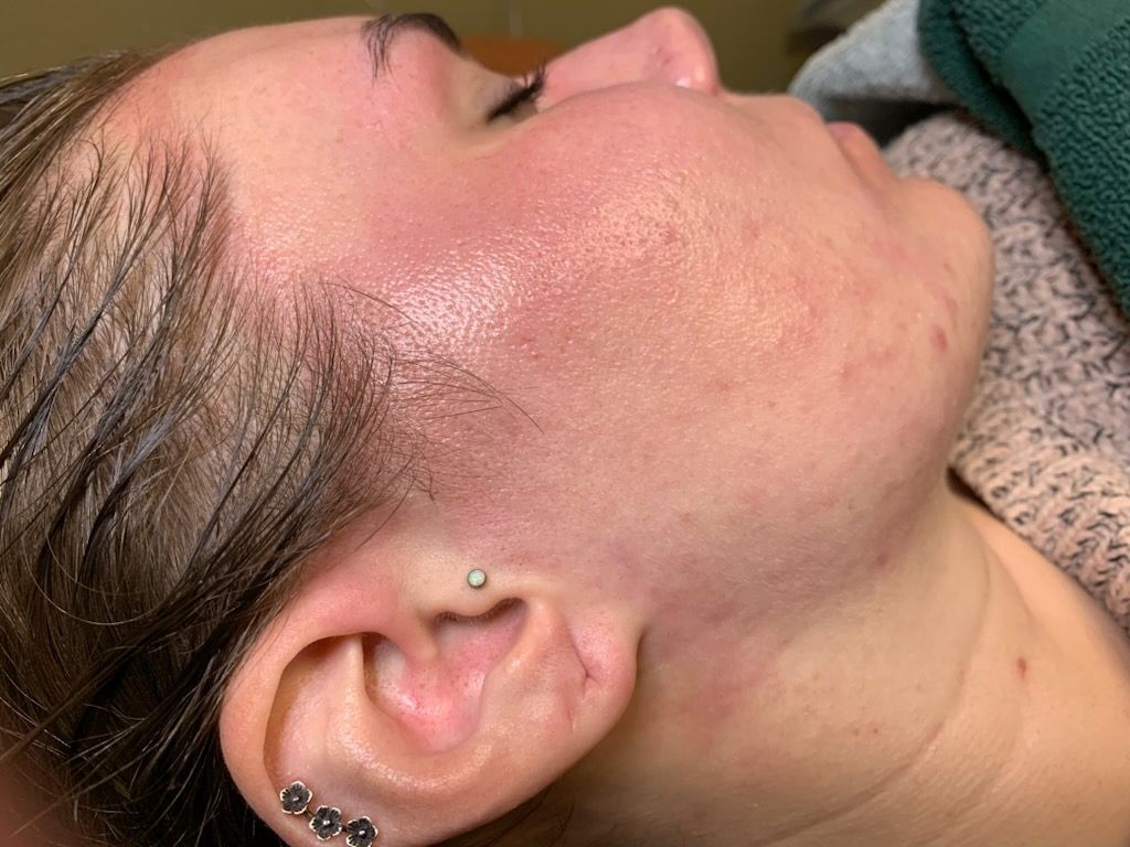 A close up of a woman 's face and ear with earrings.
