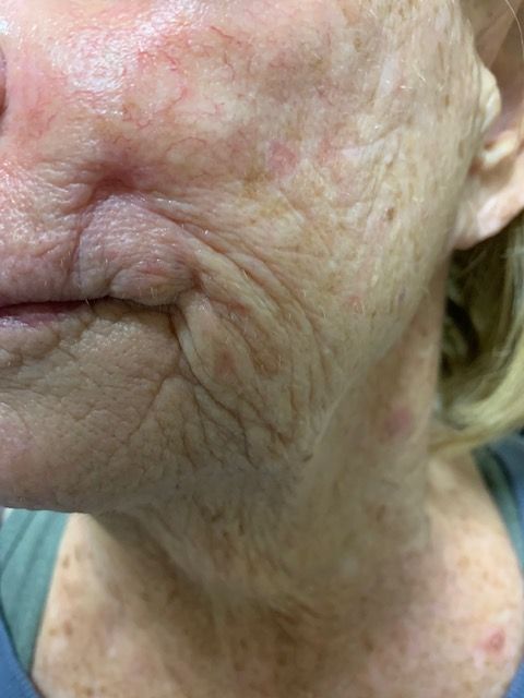 A close up of an older woman 's face and neck.