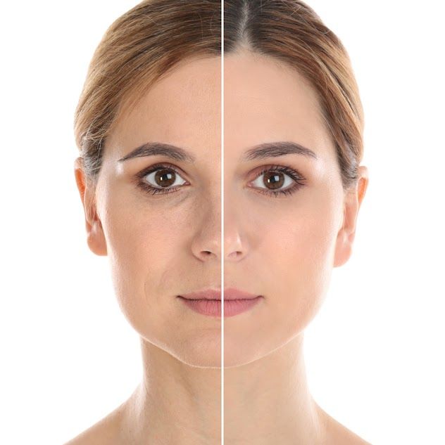 A before and after photo of a woman 's face