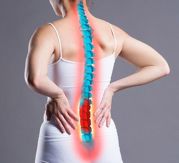 Woman With Backache — Chiropractor