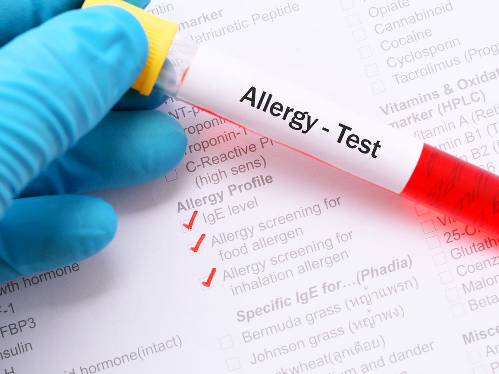 Different Reasons You Might Visit an Allergist